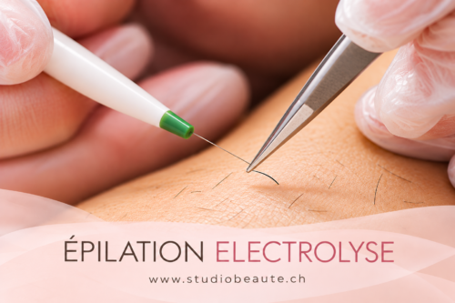 Épilation électrolyse à Genève au Studio Beauté Rosemary